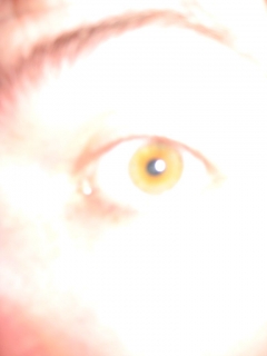 131